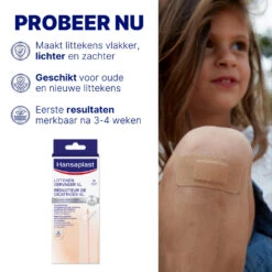 Hansaplast Littekenvervager XL -Verzorgingsproducten 997370 3